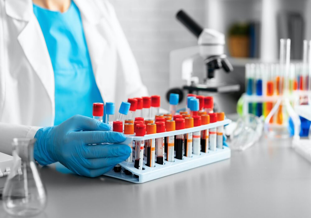 Hands of laboratory worker holding tray with blood samples